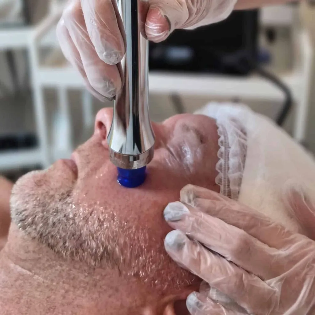 Aqua-Dermabrasion