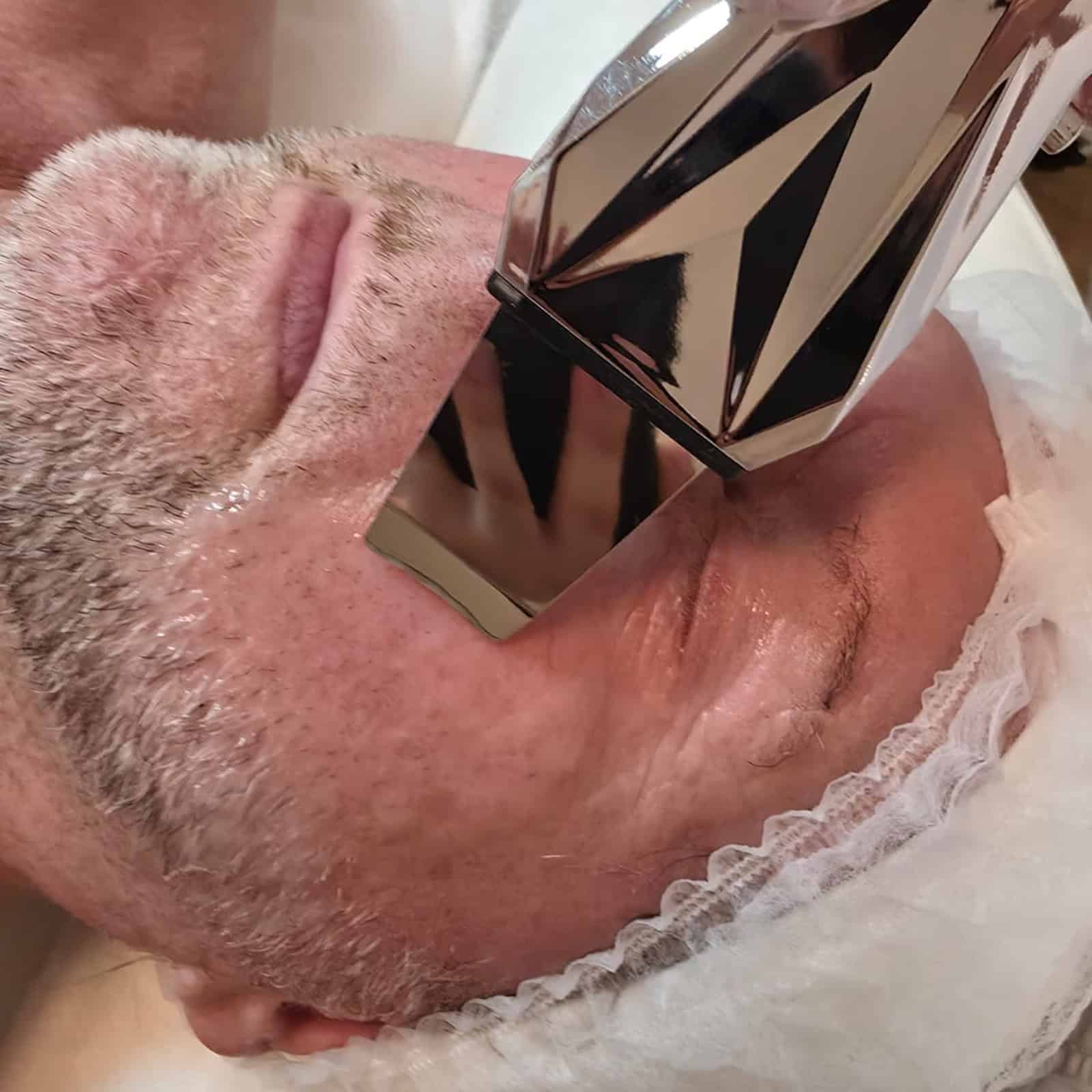 Ultraschall Gesichtsreinigung & Kombinierte Reinigung